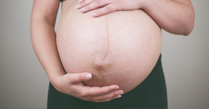 妊娠紋、肥胖紋、生長紋，如何預防？