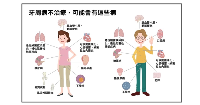 牙周病快治療，以免越拖越需要拔牙